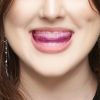 ULTIMATE BEAUTY - LIP ASSIST -  Jastučić za zatezanje usana za PMU